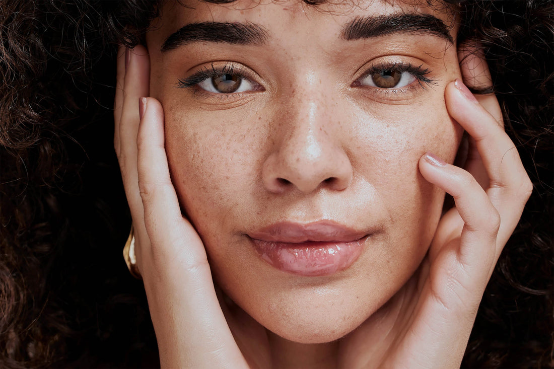 Pigment Spots – Unique Beauty Mark or Unwanted Skin Concern?
