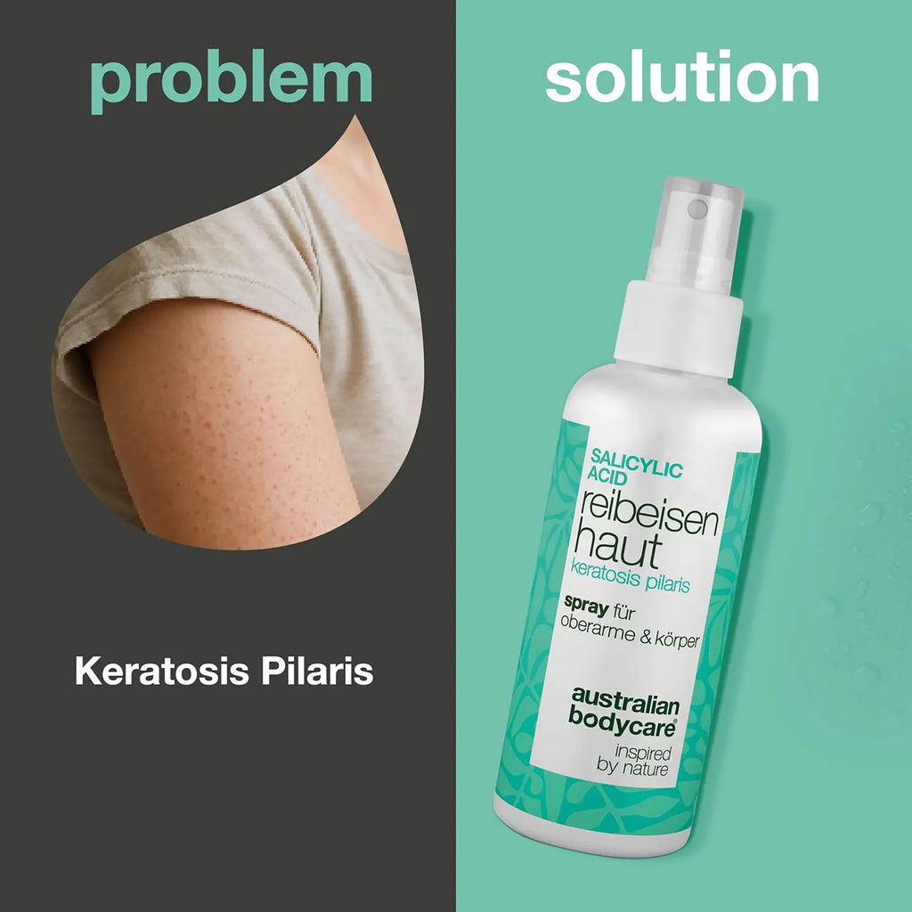 australian bodycare Spray Kératose Pilaire avec Acide Salicylique, 100 ml