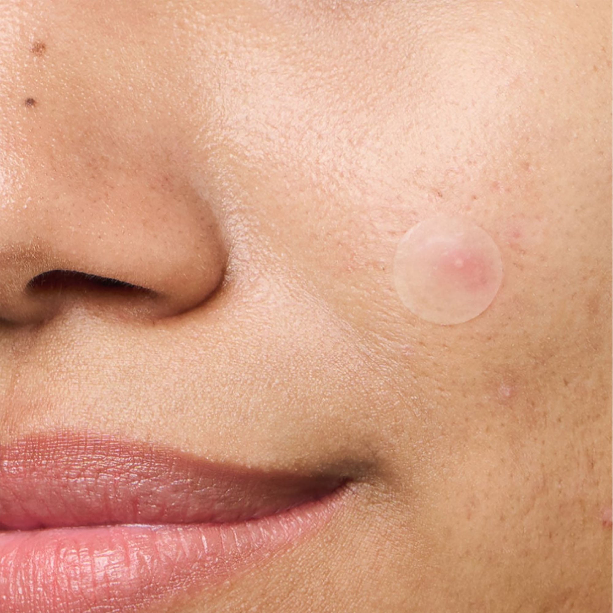 Hero Mighty Patch invisible+ pimple patches, 24 Count