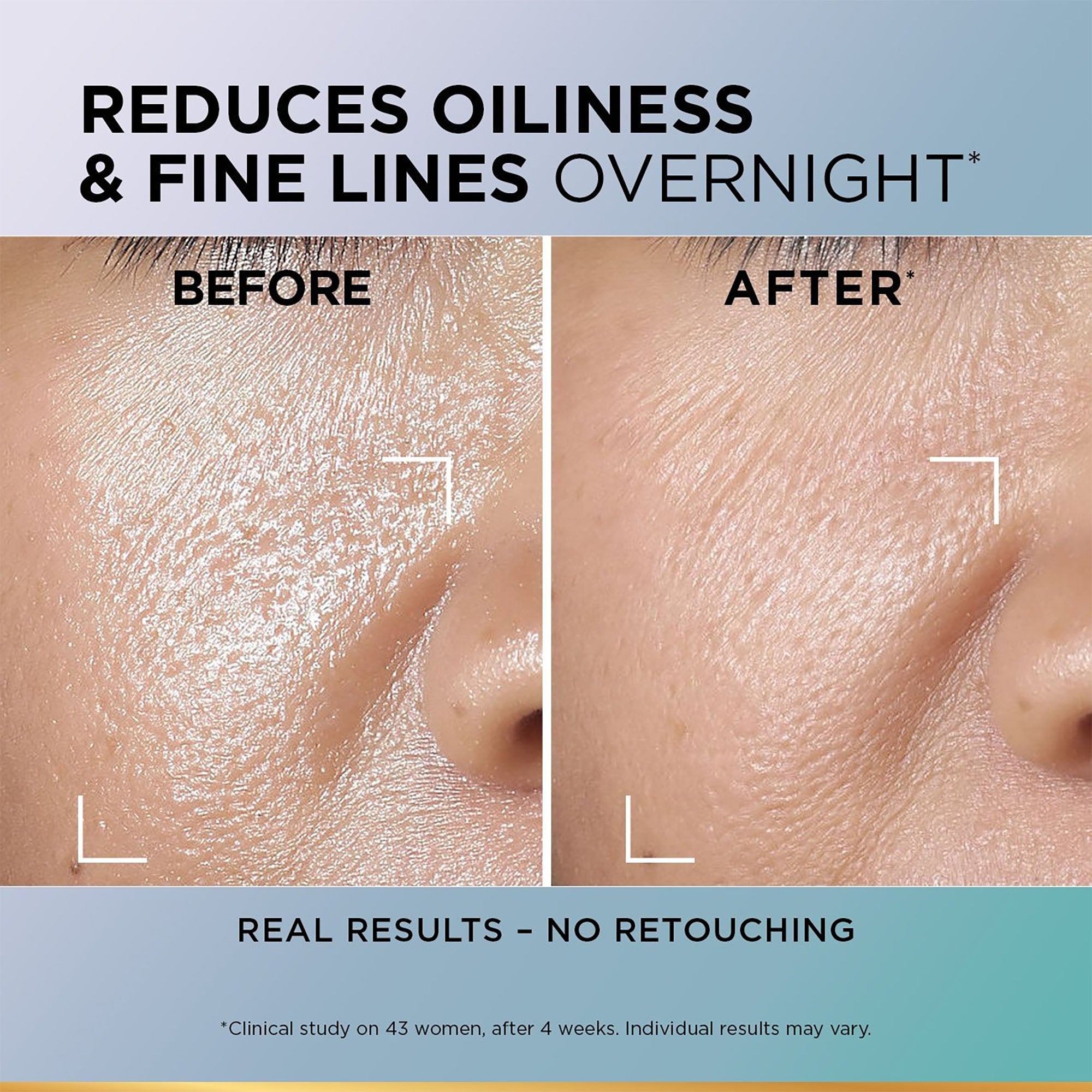 L'Oréal Paris Sérum Repulpant Nuit Revitalift Oil Control, 30 ml